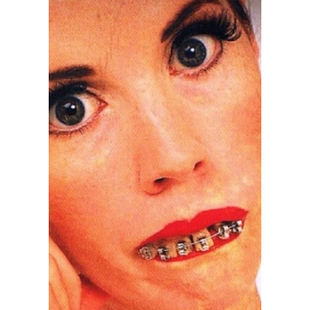 Dientes con aparato - Dentaduras