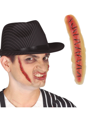 Scar Suture