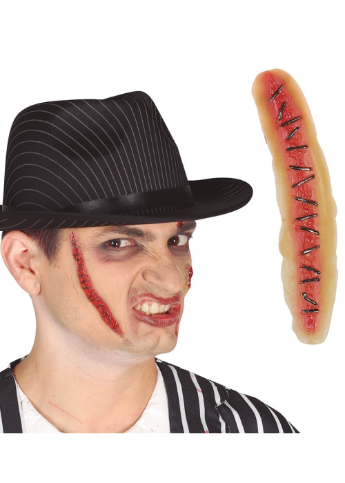 Scar Suture